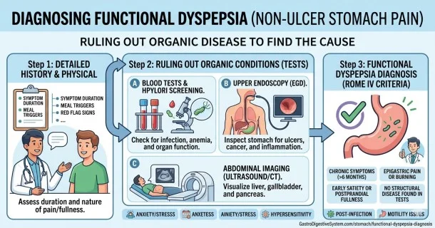 Infographic detailing the diagnosis of Functional Dyspepsia, featuring the Rome IV symptom criteria checklist, upper endoscopy view, H. pylori breath testing, and gastric emptying studies alongside a red flag alarm features panel.